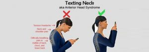 Chiropractic Care for Text Neck in Kirkland WA