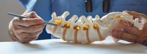 What Is A Subluxation?