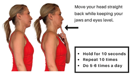 Chiropractic Kirkland WA Chin Retraction Chiropractic Kirkland WA Chin Retraction